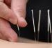 George's Massage, Acupuncture and Osteopathic Clinic, Richmond Hill