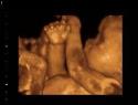3D BabyVision Fetal Imaging company logo