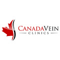 Canada Vein Clinics company logo