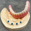 Peace Arch Denture Clinic company logo