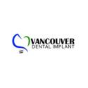 Vancouver Dental Implant company logo